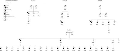 DSP c.6310delA p.(Thr2104Glnfs*12) associates with arrhythmogenic cardiomyopathy, increased trabeculation, curly hair, and palmoplantar keratoderma